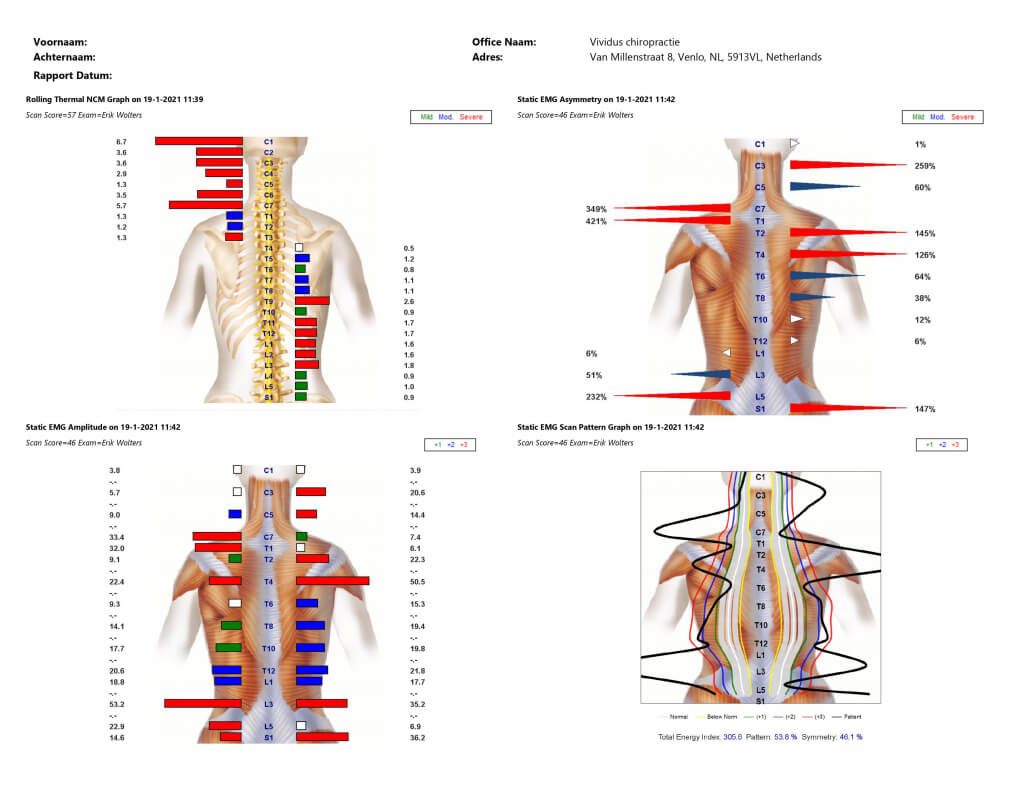 Rug- en Nekscan - 2 - Chiropractie Praktijk Vividus - Centrum voor Gezondheid Venlo